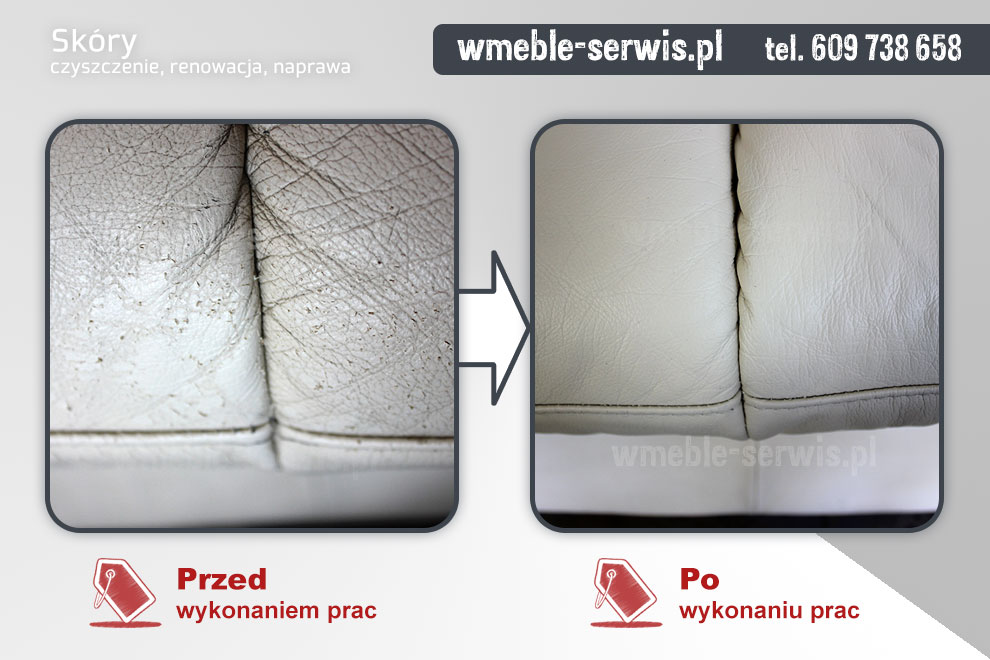 Naprawa łuszczącej się skóry